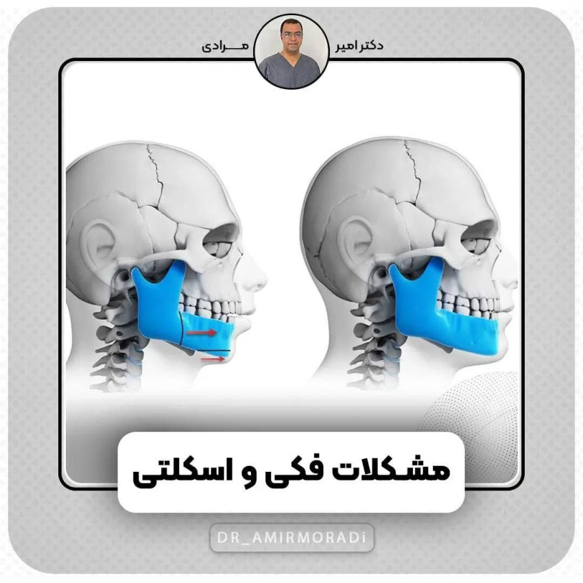 چه زمانی نیاز به ارتودنسی است