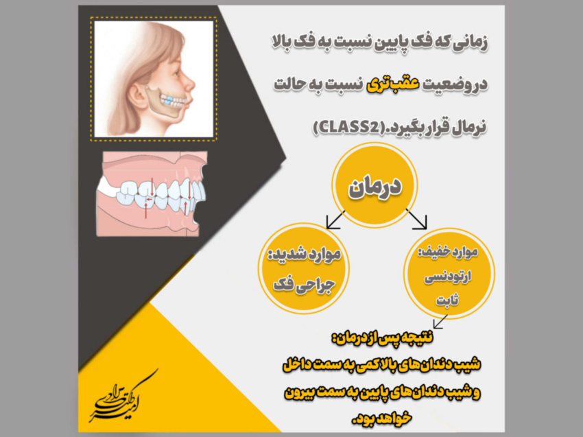 انواع روابط فکی