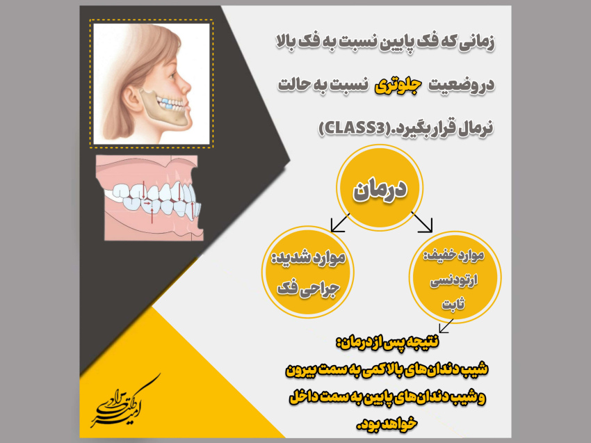 انواع روابط فکی