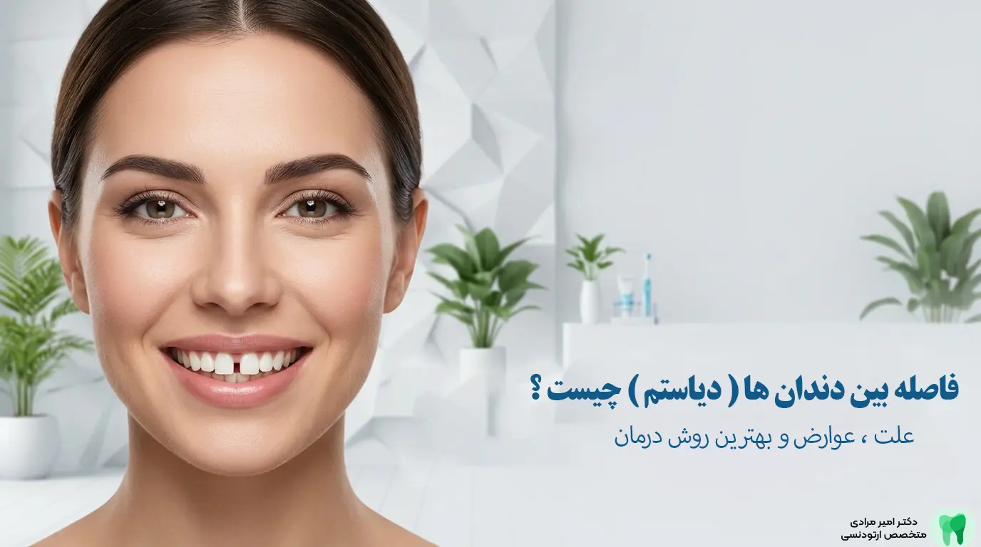 فاصله بین دندان‌ها (دیاستم) چیست و روش‌های درمان آن